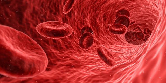 Thrombophlebitis